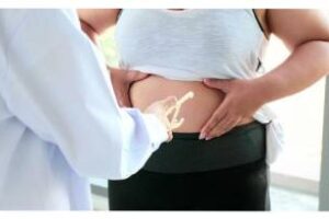 Salud:El 04 de marzo,es el Día Mundial de la Obesidad